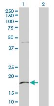 Anti-KLRG1 Rabbit Polyclonal Antibody