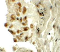 Anti-TYW1 Rabbit Polyclonal Antibody