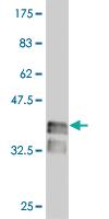 Anti-LHX4 Mouse Monoclonal Antibody [clone: 3B4]