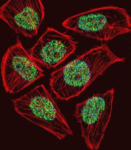 Anti-TADA3 Rabbit Polyclonal Antibody (APC (Allophycocyanin))