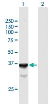 Anti-SLC25A3 Mouse Polyclonal Antibody