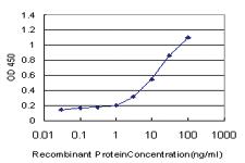 Anti-NEK4 Mouse Monoclonal Antibody [clone: 2E9]