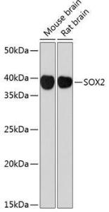 Western blot analysis of extracts of various cell lines, using Anti-SOX2 Antibody [ARC0449] (A308010) at 1:1,000 dilution. The secondary antibody was Goat Anti-Rabbit IgG H&L Antibody (HRP) at 1:10,000 dilution.