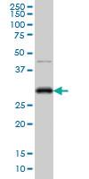 Anti-CDK1 Mouse Monoclonal Antibody [clone: 1G10]