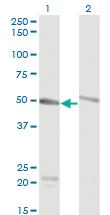 Anti-TUBA1C Mouse Monoclonal Antibody [clone: 1D2-H5]