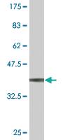 Anti-TOPORS Mouse Monoclonal Antibody [clone: 1A5]