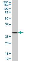 Anti-CDK1 Mouse Monoclonal Antibody [clone: 1G10]