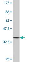 Anti-LHX4 Mouse Monoclonal Antibody [clone: 4F6]