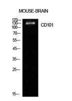 Anti-CD101 antibody