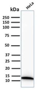 Western blot analysis of human HeLa cell lysate using Anti-S100A4 Antibody [S100A4/2750R]