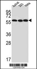 Anti-UTP6 Rabbit Polyclonal Antibody