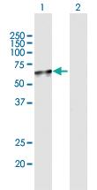 Anti-NADK Mouse Polyclonal Antibody