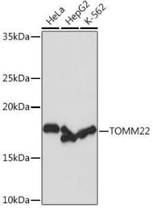 Anti-TOMM22 / TOM22 Rabbit Monoclonal Antibody [clone: ARC1688]