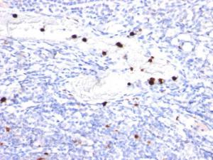 Immunohistochemical analysis of formalin-fixed, paraffin-embedded human tonsil using Anti-Cystatin A Antibody [CPTC-CSTA-1]