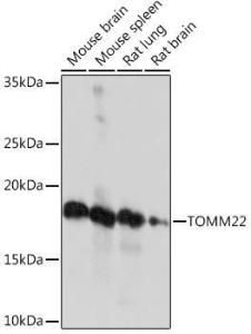 Anti-TOMM22 / TOM22 Rabbit Monoclonal Antibody [clone: ARC1688]