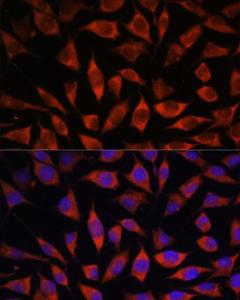 Anti-POGLUT1 Rabbit Polyclonal Antibody