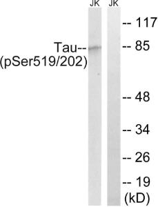 Antibody anti-TAU phospho SER519 SER202