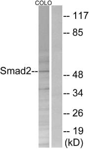 Western blot analysis of lysates from COLO205 cells, treated with serum 20% 15' using Anti-Smad2 Antibody The right hand lane represents a negative control, where the antibody is blocked by the immunising peptide