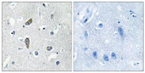 Antibody anti-CDK5RAP2 100 µg