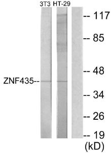 Western blot analysis of lysates from NIH/3T3 and HT-29 cells using Anti-ZNF435 Antibody. The right hand lane represents a negative control, where the antibody is blocked by the immunising peptide.