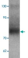 Anti-TYW3 Rabbit Polyclonal Antibody