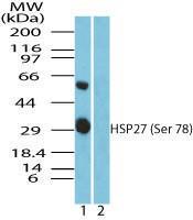 Anti-HSPB1 Rabbit Polyclonal Antibody