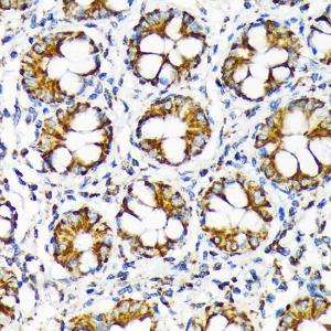 Anti-TOMM22 / TOM22 Rabbit Monoclonal Antibody [clone: ARC1688]