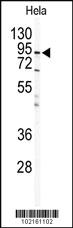 Anti-IKBKB Rabbit Polyclonal Antibody