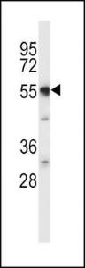 Anti-SLC11A2 Rabbit Polyclonal Antibody (HRP (Horseradish Peroxidase))