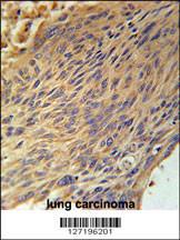 Anti-CPEB4 Rabbit Polyclonal Antibody (APC (Allophycocyanin))