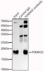 Anti-TOMM22 / TOM22 Rabbit Monoclonal Antibody [clone: ARC1688]