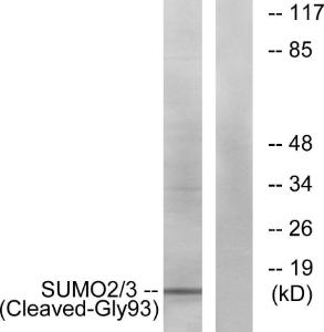 Western blot analysis of lysates from HeLa cells using Anti-SUMO2 + SUMO3 (cleaved Gly93) Antibody. The right hand lane represents a negative control, where the antibody is blocked by the immunising peptide