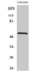 Western blot analysis of various cells using Anti-Smad2 Antibody