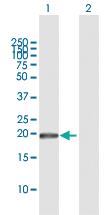 Anti-GUK1 Rabbit Polyclonal Antibody