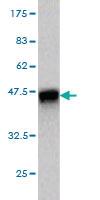 Anti-KLK8 Mouse Monoclonal Antibody [clone: 2F11]