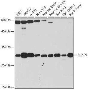 Western blot analysis of extracts of various cell lines, using Anti-ERp29 Antibody [ARC2295] (A306789) at 1:1000 dilution. The secondary Antibody was Goat Anti-Rabbit IgG H&L Antibody (HRP) at 1:10000 dilution. Lysates/proteins were present at 25 µg per lane