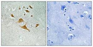 Anti-CDK5RAP1 Rabbit Polyclonal Antibody