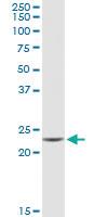 Anti-GUK1 Rabbit Polyclonal Antibody