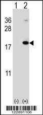 Anti-RNF5 Rabbit Polyclonal Antibody (AP (Alkaline Phosphatase))