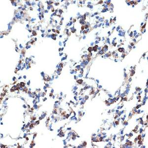 Immunohistochemistry analysis of paraffin-embedded rat lung using Anti-ERp29 Antibody [ARC2295] (A306789) at a dilution of 1:100 (40X lens). Perform microwave antigen retrieval with 10 mM Tris/EDTA buffer pH 9.0 before commencing with IHC staining protocol