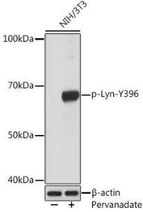 Western blot analysis of extracts of NIH/3T3 cells, using Anti-Lyn (phospho Tyr396) Antibody [ARC1597] (A305607) at 1:1000 dilution