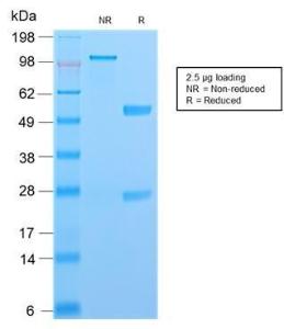 SDS-PAGE analysis of Anti-S100A4 Antibody [S100A4/2750R] under non-reduced and reduced conditions; showing intact IgG and intact heavy and light chains, respectively. SDS-PAGE analysis confirms the integrity and purity of the antibody.