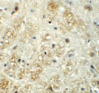 Anti-VASH1 Rabbit Polyclonal Antibody