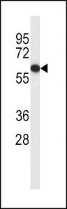 Anti-ESR1 Rabbit Polyclonal Antibody (HRP (Horseradish Peroxidase))