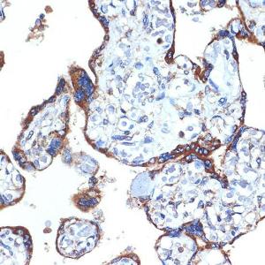 Immunohistochemistry analysis of paraffin-embedded human placenta using Anti-ERp29 Antibody [ARC2295] (A306789) at a dilution of 1:100 (40X lens). Perform microwave antigen retrieval with 10 mM Tris/EDTA buffer pH 9.0 before commencing with IHC staining protocol