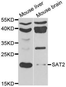 Antibody anti-SAT2 100 µl