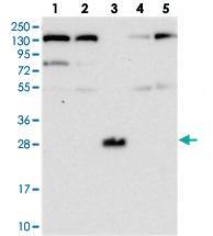 Anti-C15ORF59 Rabbit Polyclonal Antibody