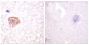 Immunohistochemical analysis of paraffin-embedded human brain tissue using Anti-DDX3 Antibody. The right hand panel represents a negative control, where the antibody was pre-incubated with the immunising peptide