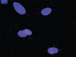 Anti-PRKCD + PRKCD Antibody Pair