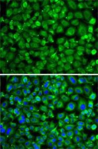 Antibody anti-SAT2 100 µl